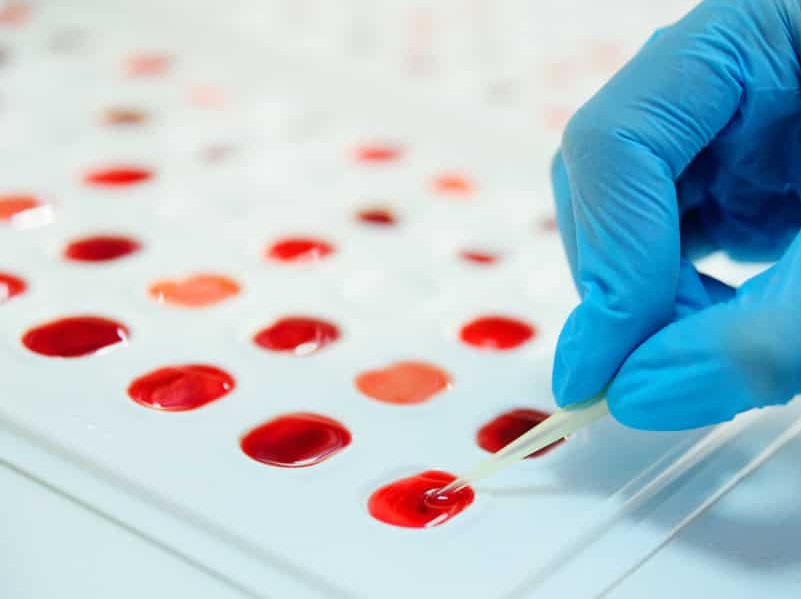 Ematologia di Laboratorio